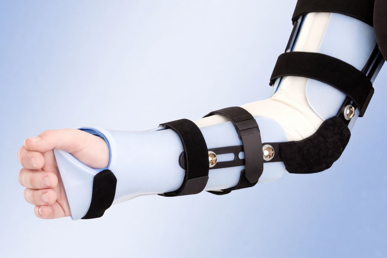 08-09-30 Аппарат на локтевой сустав